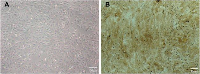 https://cdn.ncbi.nlm.nih.gov/pmc/blobs/9940/10475539/40975b014059/fbioe-11-1251947-g005.jpg