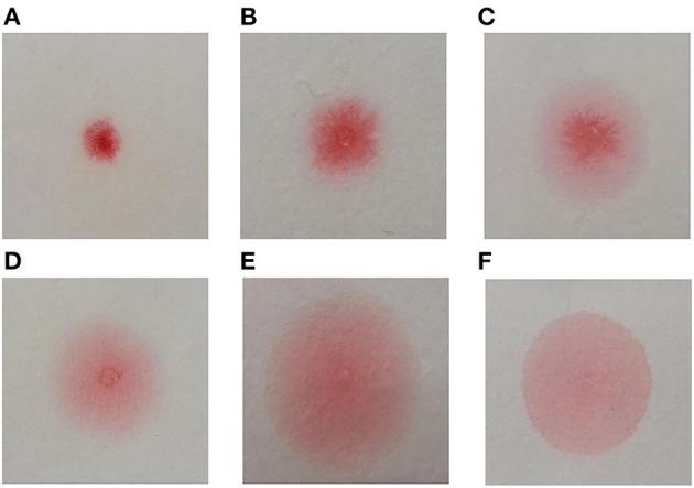 https://cdn.ncbi.nlm.nih.gov/pmc/blobs/9942/8365157/93c2c1f9f774/fmed-08-700157-g0001.jpg
