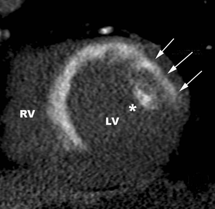 https://cdn.ncbi.nlm.nih.gov/pmc/blobs/9948/3035779/84b8c2a4b526/10554_2010_9714_Fig5_HTML.jpg