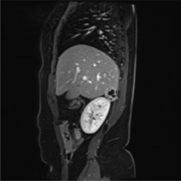 https://cdn.ncbi.nlm.nih.gov/pmc/blobs/9953/5329862/40b283fda484/j_med-2016-0075_fig_003.jpg