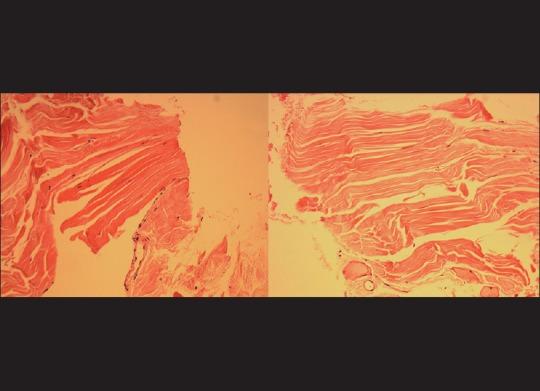 https://cdn.ncbi.nlm.nih.gov/pmc/blobs/9957/4821130/8b726ed15b18/IJO-64-91-g003.jpg
