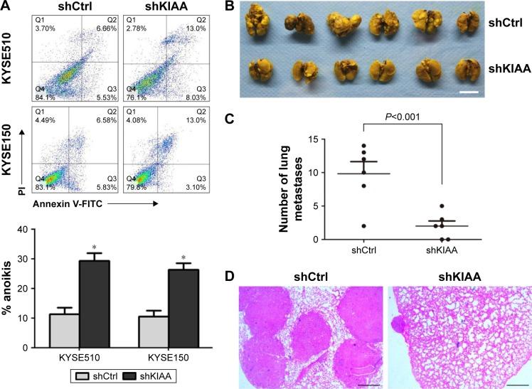https://cdn.ncbi.nlm.nih.gov/pmc/blobs/9957/5538704/18c736af17b2/ott-10-3743Fig5.jpg