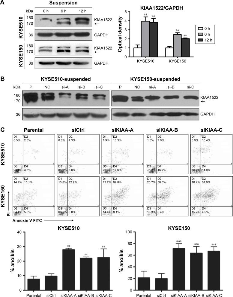 https://cdn.ncbi.nlm.nih.gov/pmc/blobs/9957/5538704/1931bbd46770/ott-10-3743Fig4.jpg