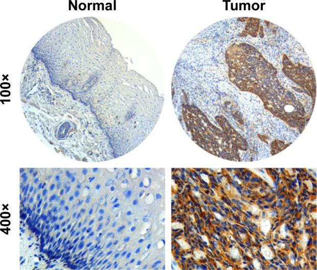 https://cdn.ncbi.nlm.nih.gov/pmc/blobs/9957/5538704/5ac0114e59ef/ott-10-3743Fig1.jpg