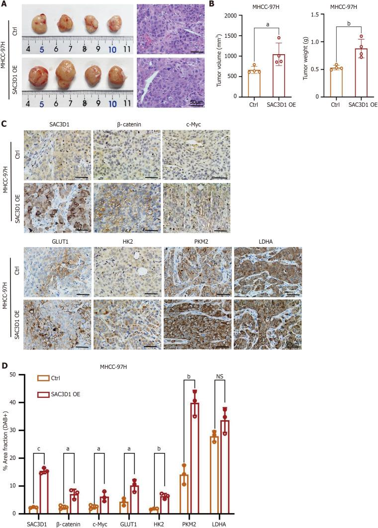 https://cdn.ncbi.nlm.nih.gov/pmc/blobs/9958/12278251/7d20b725972a/wjgo-17-7-107971-g007.jpg