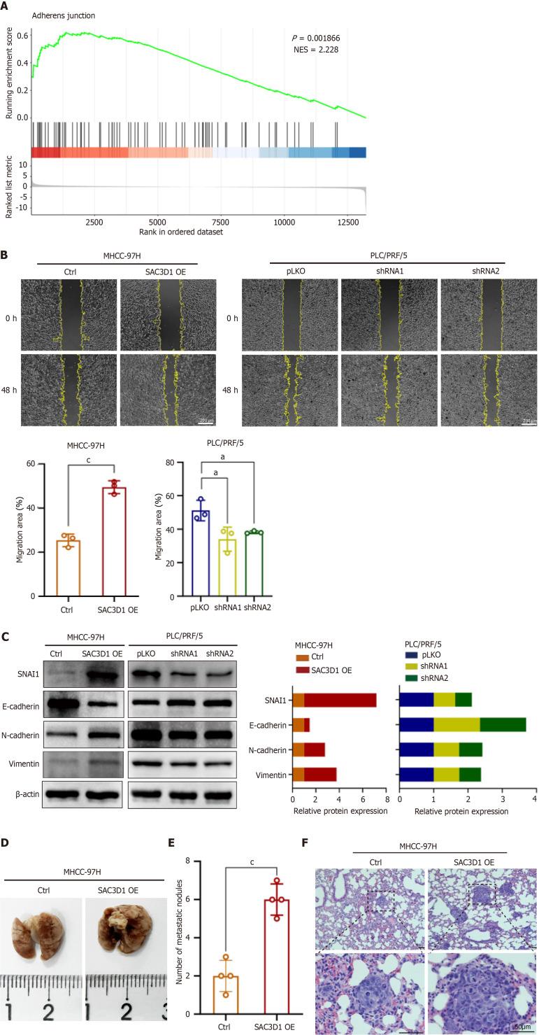 https://cdn.ncbi.nlm.nih.gov/pmc/blobs/9958/12278251/a606673926e3/wjgo-17-7-107971-g003.jpg