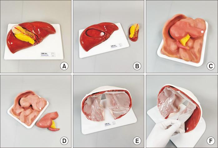 https://cdn.ncbi.nlm.nih.gov/pmc/blobs/995a/12179672/ebf478320d2e/jmis-28-2-108-f1.jpg