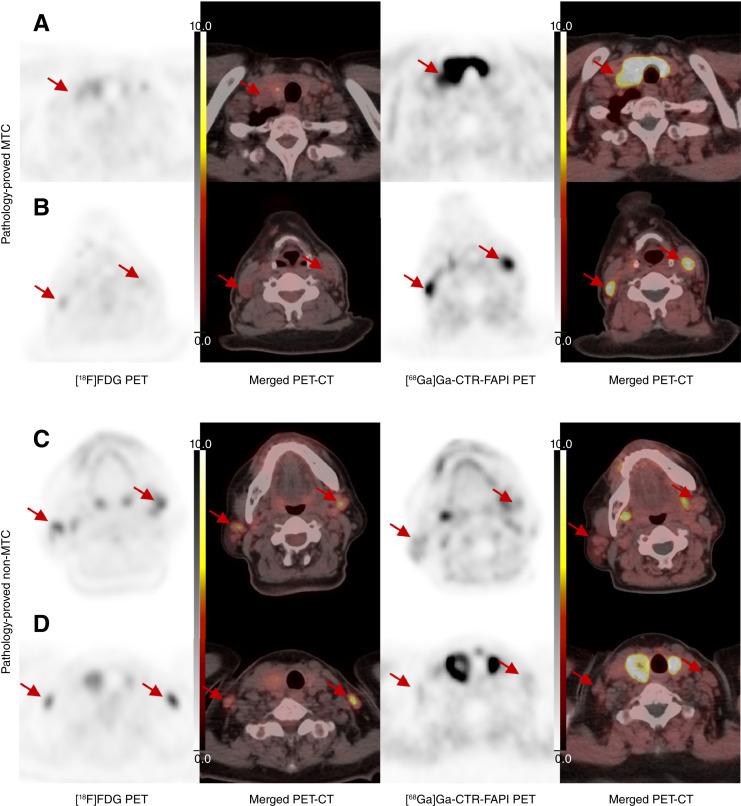 https://cdn.ncbi.nlm.nih.gov/pmc/blobs/995e/11803395/82e3339e7036/cd-24-0897fig3.jpg