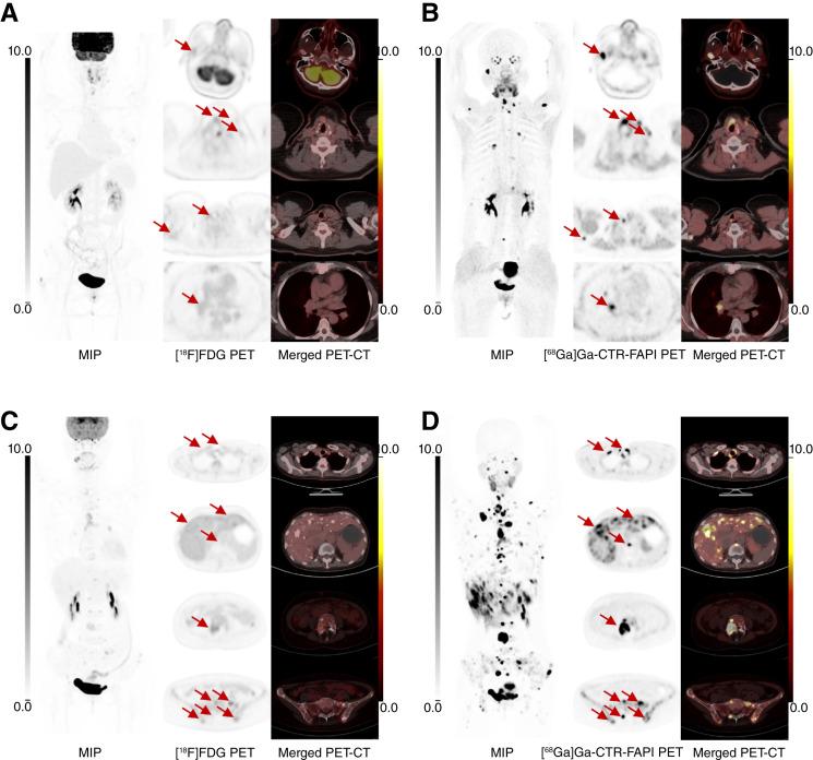 https://cdn.ncbi.nlm.nih.gov/pmc/blobs/995e/11803395/aaa9ad113de8/cd-24-0897fig2.jpg