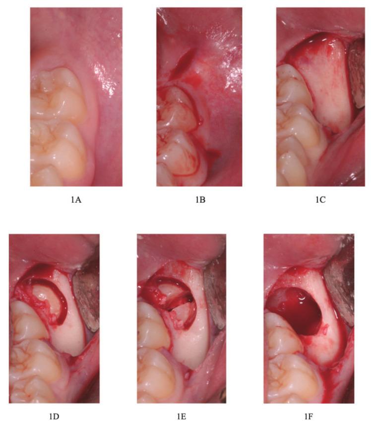 https://cdn.ncbi.nlm.nih.gov/pmc/blobs/995f/7912446/cd15f25fbb82/healthcare-09-00121-g001a.jpg