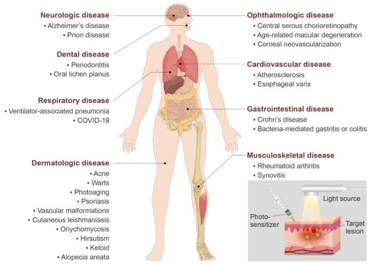 https://cdn.ncbi.nlm.nih.gov/pmc/blobs/9961/7911939/60e87bb30383/biomedicines-09-00113-g003.jpg