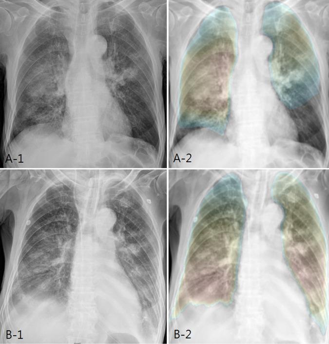 https://cdn.ncbi.nlm.nih.gov/pmc/blobs/9964/8049482/22ef1ba79048/pone.0249399.g005.jpg