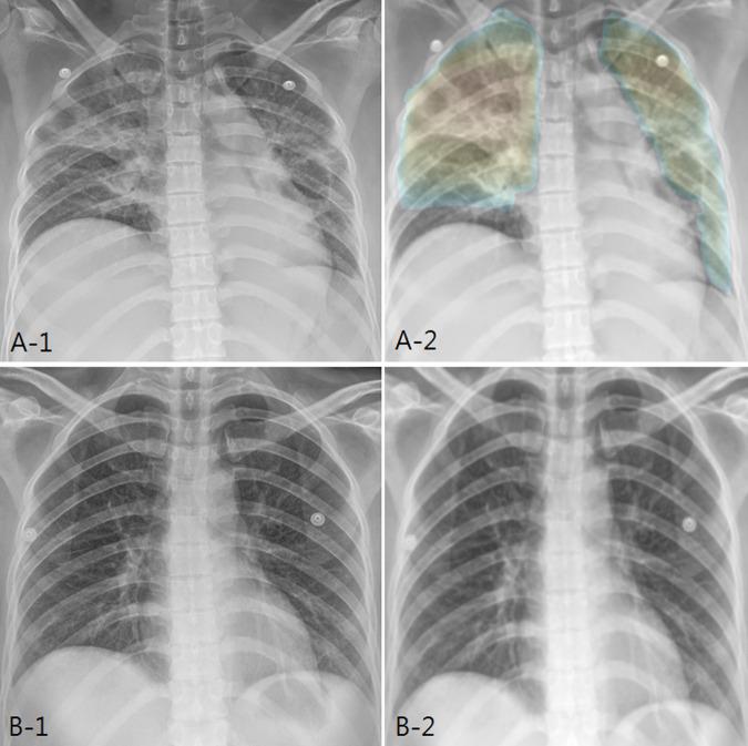 https://cdn.ncbi.nlm.nih.gov/pmc/blobs/9964/8049482/d8e27b9333e5/pone.0249399.g004.jpg