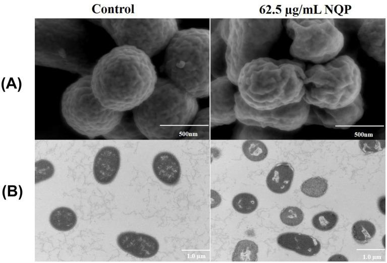 https://cdn.ncbi.nlm.nih.gov/pmc/blobs/9965/12358481/7da3800d26ad/fmicb-16-1603462-g006.jpg
