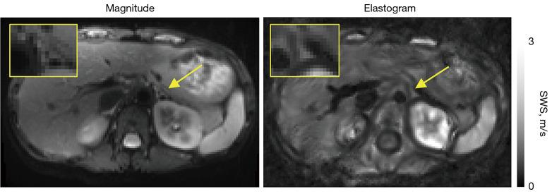 https://cdn.ncbi.nlm.nih.gov/pmc/blobs/996a/12082585/7976f4c9273b/qims-15-05-4557-f1.jpg
