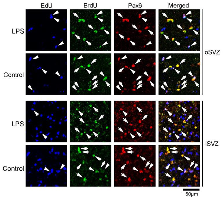 https://cdn.ncbi.nlm.nih.gov/pmc/blobs/996e/10573966/5b5b5aae1c1f/ijms-24-14962-g006.jpg