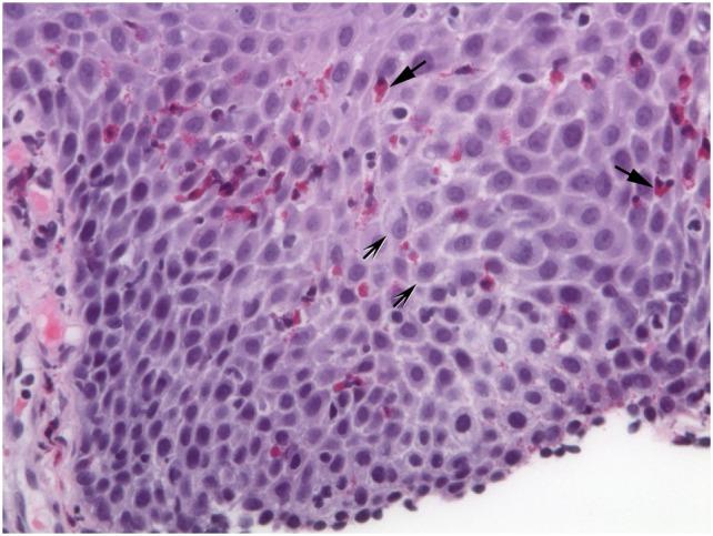 https://cdn.ncbi.nlm.nih.gov/pmc/blobs/9974/5775510/099d868e490d/fmed-04-00261-g002.jpg