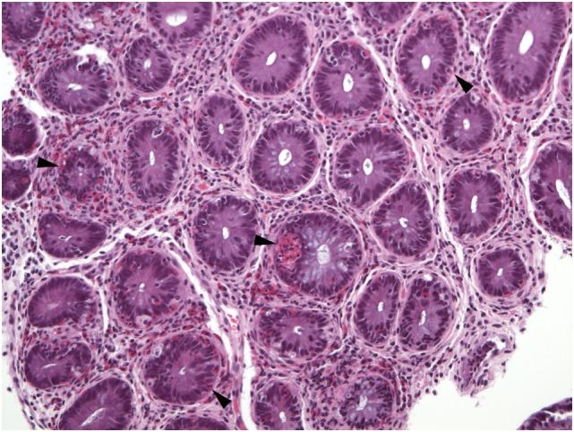 https://cdn.ncbi.nlm.nih.gov/pmc/blobs/9974/5775510/35423bd0cd33/fmed-04-00261-g008.jpg