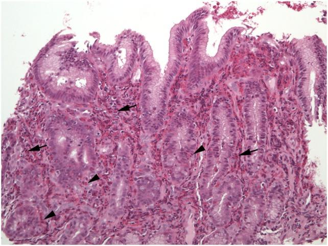 https://cdn.ncbi.nlm.nih.gov/pmc/blobs/9974/5775510/6c092061832e/fmed-04-00261-g003.jpg