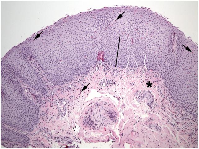 https://cdn.ncbi.nlm.nih.gov/pmc/blobs/9974/5775510/86fe4a686cad/fmed-04-00261-g001.jpg