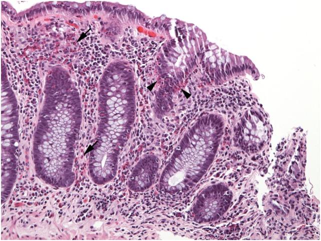https://cdn.ncbi.nlm.nih.gov/pmc/blobs/9974/5775510/8e6a8dcb4488/fmed-04-00261-g007.jpg