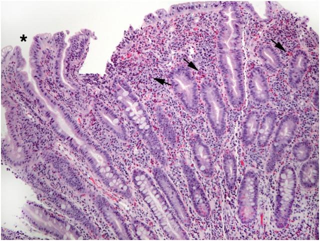 https://cdn.ncbi.nlm.nih.gov/pmc/blobs/9974/5775510/b52cf4757bd7/fmed-04-00261-g005.jpg