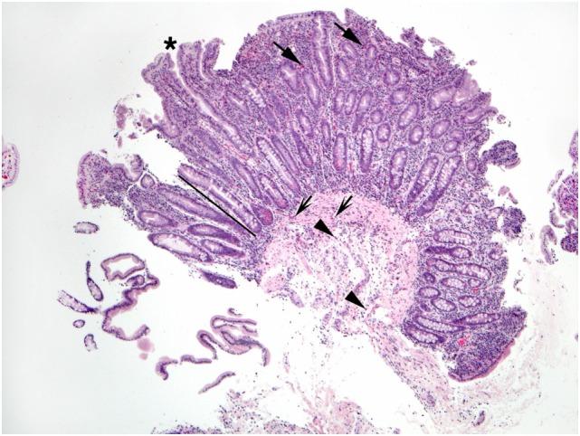 https://cdn.ncbi.nlm.nih.gov/pmc/blobs/9974/5775510/f5091fe5037f/fmed-04-00261-g004.jpg