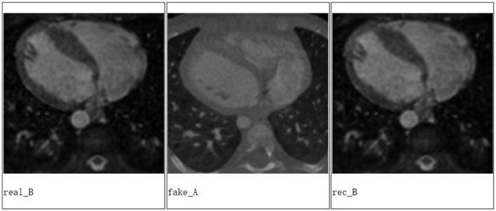 https://cdn.ncbi.nlm.nih.gov/pmc/blobs/9975/7235323/dd2f7d0ce401/fpubh-08-00164-g0003.jpg