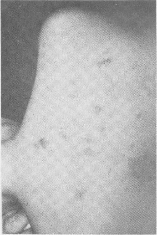 https://cdn.ncbi.nlm.nih.gov/pmc/blobs/997b/1129301/ce00f1877155/westjmed00305-0072-h.jpg