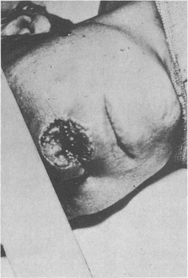 https://cdn.ncbi.nlm.nih.gov/pmc/blobs/997b/1129301/fed4332341e4/westjmed00305-0073-d.jpg