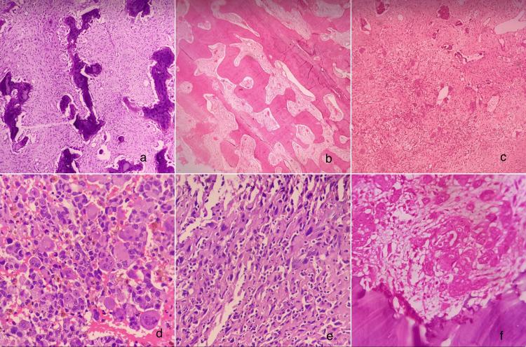 https://cdn.ncbi.nlm.nih.gov/pmc/blobs/9984/11184533/0b2852070dbc/cureus-0016-00000060574-i02.jpg
