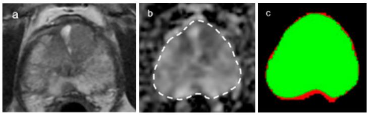 https://cdn.ncbi.nlm.nih.gov/pmc/blobs/9996/10453750/495b5d402a5a/curroncol-30-00528-g002.jpg
