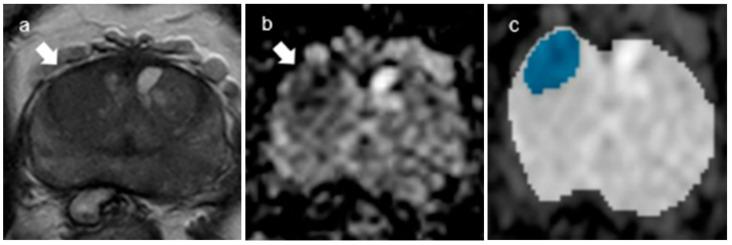 https://cdn.ncbi.nlm.nih.gov/pmc/blobs/9996/10453750/e1fc81fb0ee9/curroncol-30-00528-g005.jpg