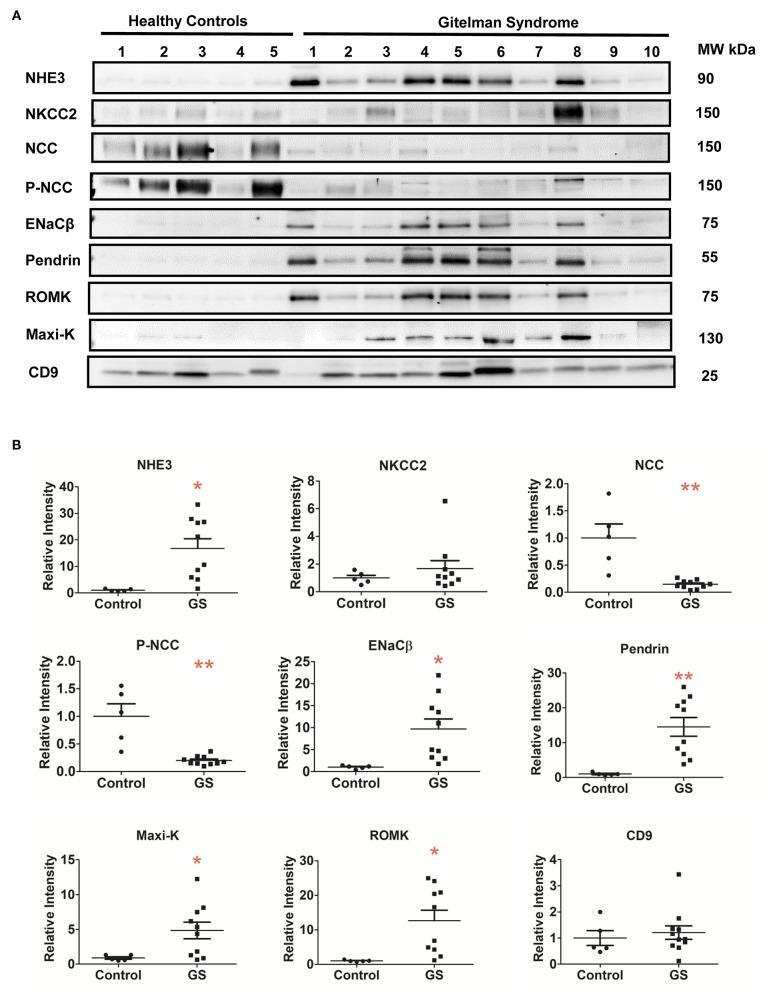 https://cdn.ncbi.nlm.nih.gov/pmc/blobs/999e/8219937/2b90d6453b5c/fmed-08-679171-g0002.jpg