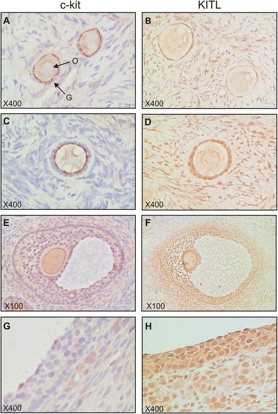 https://cdn.ncbi.nlm.nih.gov/pmc/blobs/99a0/4460643/e45b933e4af8/13048_2015_159_Fig5_HTML.jpg