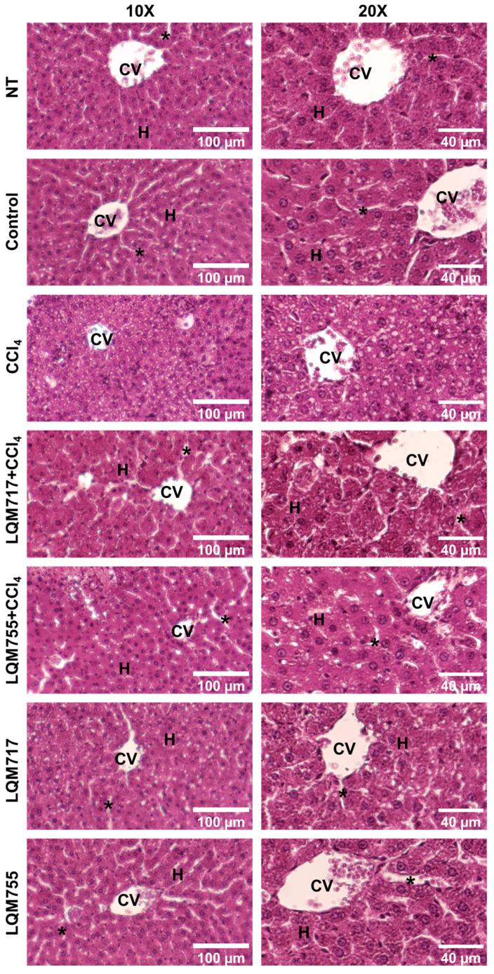https://cdn.ncbi.nlm.nih.gov/pmc/blobs/99a6/12109523/9561625968af/biomedicines-13-01094-g011.jpg
