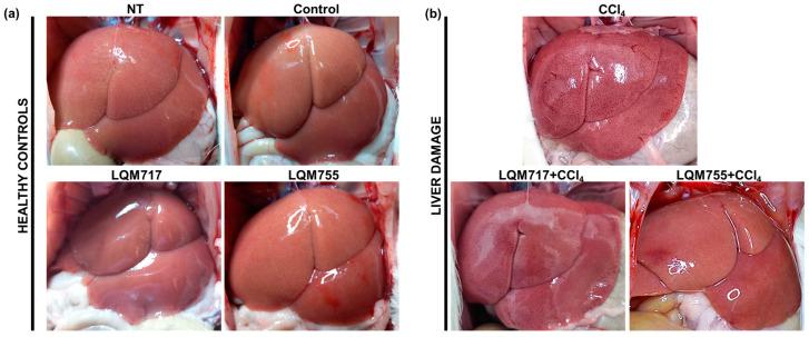 https://cdn.ncbi.nlm.nih.gov/pmc/blobs/99a6/12109523/db6f2ea54be8/biomedicines-13-01094-g009.jpg