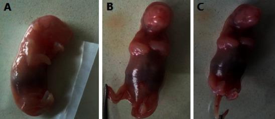 https://cdn.ncbi.nlm.nih.gov/pmc/blobs/99a6/9017522/99e548ca2b61/JT2022-4091839.003.jpg