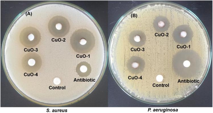 https://cdn.ncbi.nlm.nih.gov/pmc/blobs/99ab/11096669/a7e73da6d341/IJN-19-4137-g0020.jpg