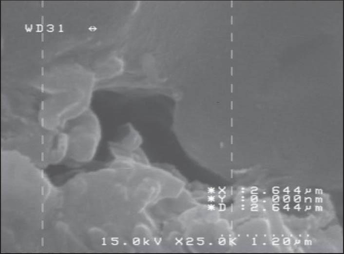 https://cdn.ncbi.nlm.nih.gov/pmc/blobs/99b3/3955302/3a3b5265b632/DRJ-11-100-g005.jpg