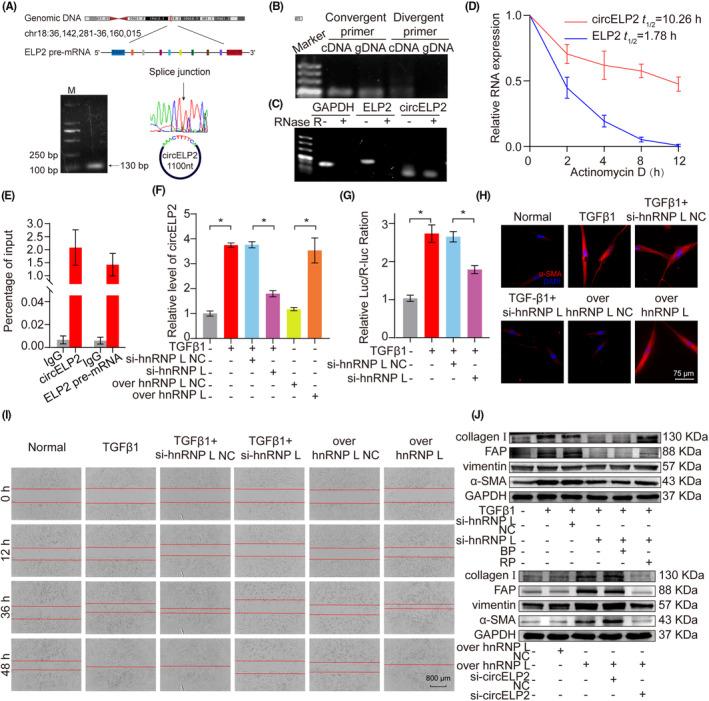 https://cdn.ncbi.nlm.nih.gov/pmc/blobs/99b7/10844706/82fcffcb9124/JCMM-28-e18098-g001.jpg