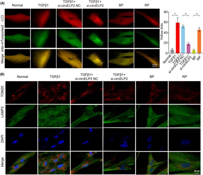 https://cdn.ncbi.nlm.nih.gov/pmc/blobs/99b7/10844706/ade9519d523f/JCMM-28-e18098-g004.jpg