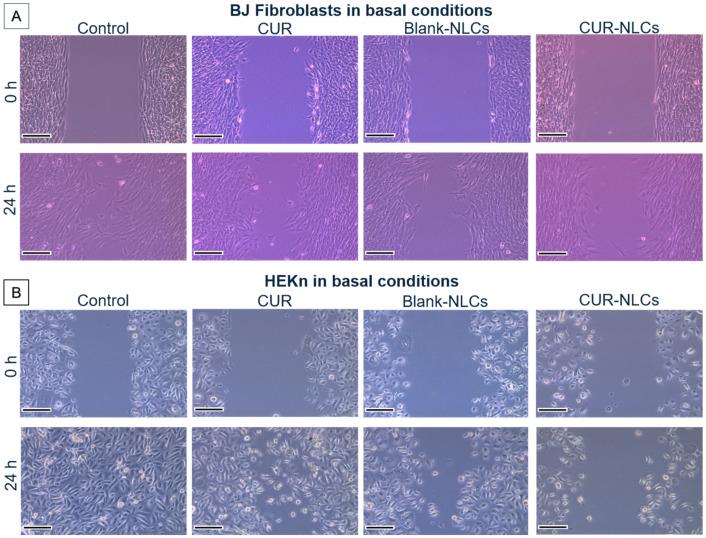 https://cdn.ncbi.nlm.nih.gov/pmc/blobs/99c4/9221280/10e8380c1f63/biomolecules-12-00780-g011.jpg