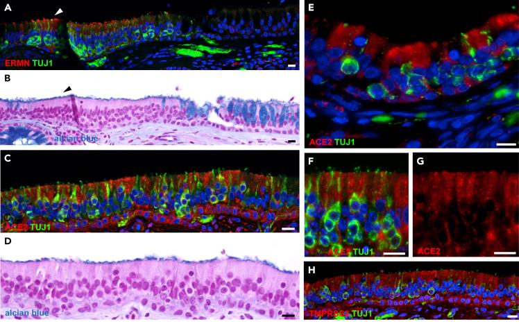 https://cdn.ncbi.nlm.nih.gov/pmc/blobs/99c6/7721638/311bd0718f53/gr4.jpg