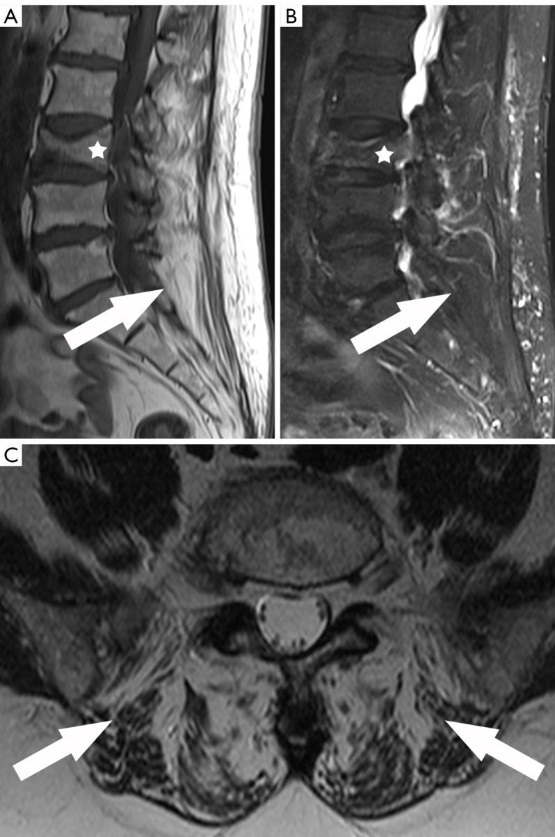 https://cdn.ncbi.nlm.nih.gov/pmc/blobs/99c8/11151258/6eb17f4afd26/qims-14-06-4189-f3.jpg