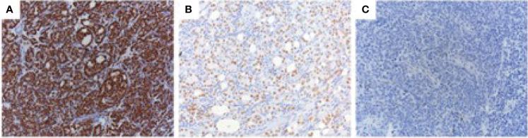 https://cdn.ncbi.nlm.nih.gov/pmc/blobs/99cf/8417043/835c8dce6f07/fonc-11-721659-g001.jpg