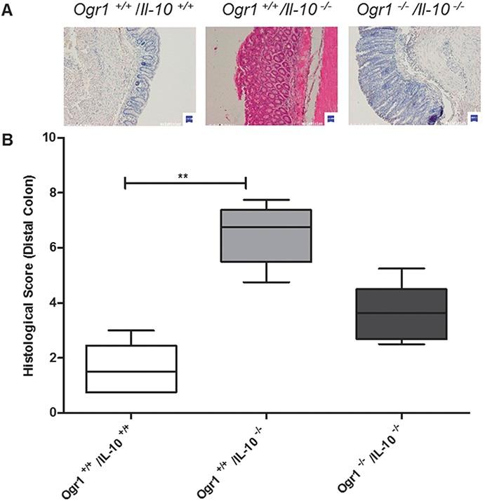 https://cdn.ncbi.nlm.nih.gov/pmc/blobs/99d2/4450952/42e9c8bb3fdd/ibd-21-1269-g008.jpg