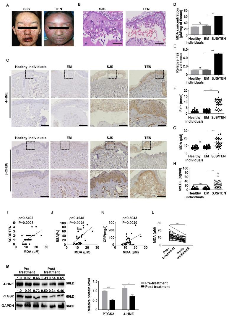 https://cdn.ncbi.nlm.nih.gov/pmc/blobs/99d5/11781181/8577ff09b9f3/ijbsv21p1275g001.jpg