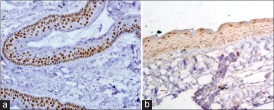 https://cdn.ncbi.nlm.nih.gov/pmc/blobs/99d5/12283042/9df4e6e6972a/JOMFP-29-286-g002.jpg