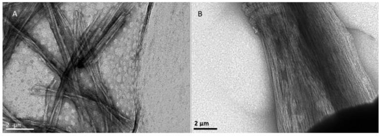 https://cdn.ncbi.nlm.nih.gov/pmc/blobs/99d6/7023140/ace95923f913/biomolecules-10-00007-g006.jpg